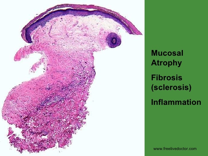 cunnilingus with lichen sclerosis Tabitha faith clit